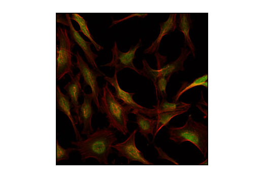 Confocal immunofluorescent analysis of HeLa cells labeled with RSK1/RSK2/RSK3 (32D7) Rabbit mAb (green). Actin filaments have been labeled with Alexa Fluor® 555 phalloidin (red).