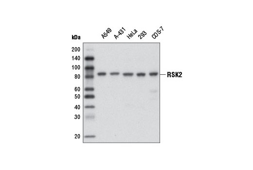 Western blot analysis of extracts from various cell lines using RSK2 (D21B2) XP ® Rabbit mAb.
