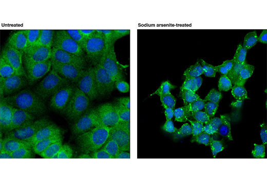 Confocal immunofluorescent analysis of MCF7 cells, untreated (left) or treated with sodium arsenite (500 uM for 1 hr; right) using RSK2 (D21B2) XP ® Rabbit mAb (green). Blue pseudocolor = DRAQ5 ® #4084 (fluorescent DNA dye). Localization of RSK2 to "stress granules" in arsenite-treated cells is very similar to that seen by Eisinger-Mathason et. al. (Molecular Cell, Volume 1, 5 September 2008, Pages 722-736).