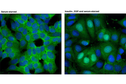 Confocal immunofluorescent analysis of MCF7 cells, untreated (left) or treated with insulin, EGF, and serum (right), using RSK2 (D21B2) XP ® Rabbit mAb (green). Blue pseudocolor = DRAQ5 ® #4084 (fluorescent DNA dye).