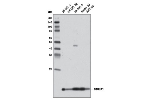 Western blot analysis of extracts from various cell lines using S100A1 Antibody.