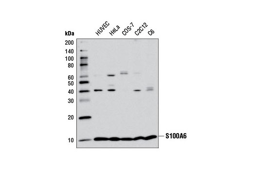 Western blot analysis of extracts from various cell lines using S100A6 (D3H3W) Rabbit mAb.