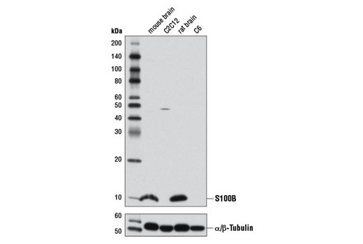 Western blot analysis of extracts from mouse brain, C2C12 cells, rat brain, and C6 cells using S100B (D10G6) Rabbit mAb (upper) and α/β-Tubulin Antibody #2148 (lower).