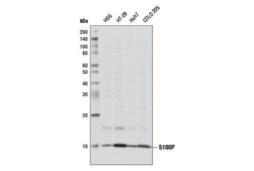 Western blot analysis of extracts from various cell lines using S100P Antibody.