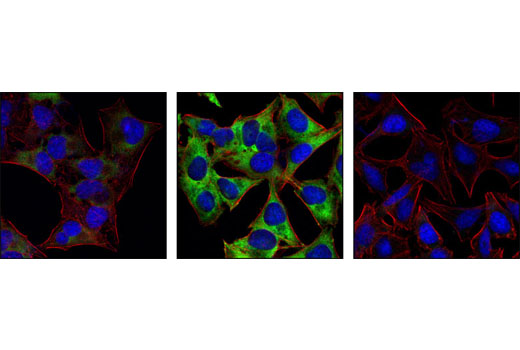 Confocal immunofluorescent images of HeLa cells serum-starved for 20 hrs (left), 20% serum-treated (center), or 20% serum-treated after preincubation with Rapamycin (FRAP/mTOR Inhibitor) #9904 and labeled with Phospho-S6 Ribosomal Protein (Ser235/236) (2F9) Rabbit mAb (green). Actin filaments have been labeled with Alexa Fluor® 555 phalloidin (red). Blue pseudocolor = DRAQ5™ (fluorescent DNA dye).