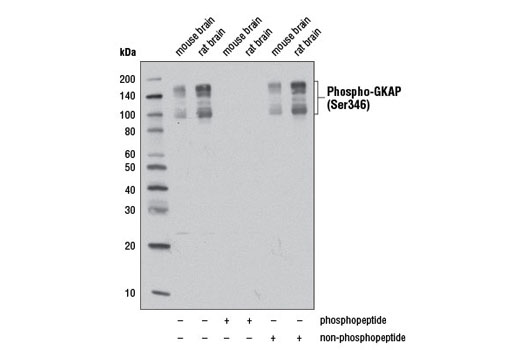 Western blot analysis of extracts from mouse and rat brain using Phospho-GKAP (Ser346) Antibody. The phospho-specificity of Phospho-GKAP (Ser346) Antibody was verified by peptide blocking using a phosphopeptide or non-phosphopeptide encompassing residue Ser346.
