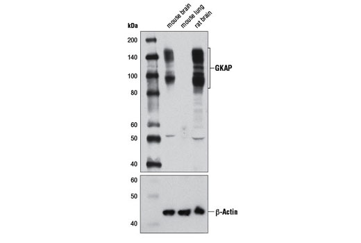 Western blot analysis of extracts from mouse brain, mouse lung, and rat brain using GKAP Antibody (upper) or β-Actin (D6A8) Rabbit mAb #8457 (lower).