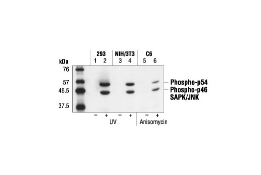Western blot analysis of extracts from 293 cells, untreated or UV-treated (lanes 1 and 2), NIH/3T3 cells, untreated or UV-treated (lanes 3 and 4) and C6 cells, untreated or anisomycin-treated (lanes 5 and 6), using Phospho-SAPK/JNK (Thr183/Tyr185) (G9) Mouse mAb.