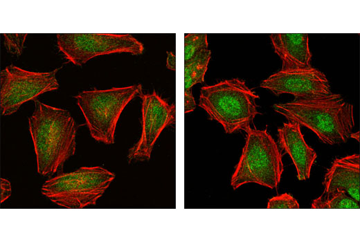 Confocal immunofluorescent analysis of HeLa cells untreated (left) and anisomycin-treated (right) using Phospho-SAPK/JNK (Thr183/Tyr185) (G9) Mouse mAb (green). Actin filaments have been labeled with DY554 phalloidin (red).