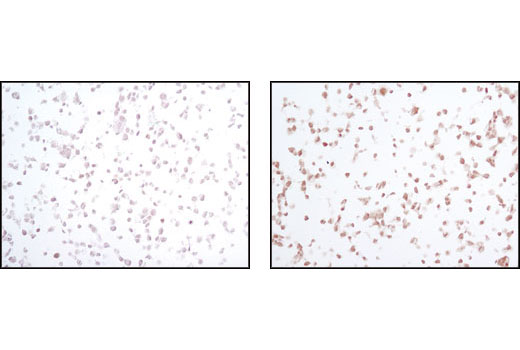 Immunohistochemical analysis of paraffin-embedded 293T cells untreated (left) or UV-treated (right) using Phospho-SAPK/JNK (Thr183/Tyr185) (81E11) Rabbit mAb.