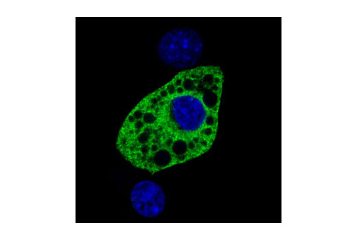 Confocal immunofluorescent analysis of 3T3-L1 cells labeled with SCD1 (R347) Antibody (green) showing cytoplasmic localization in differentiated cells. Blue pseudocolor = DRAQ5 ® #4084 (fluorescent DNA dye).