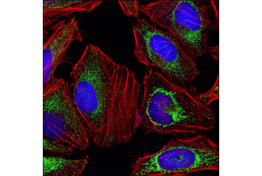 Confocal immunofluorescent analysis of HeLa cells using SDHA Antibody (green). Actin filaments were labeled with DY-554 phalloidin (red). Blue pseudocolor= DRAQ5 ® #4084 (fluorescent DNA dye).