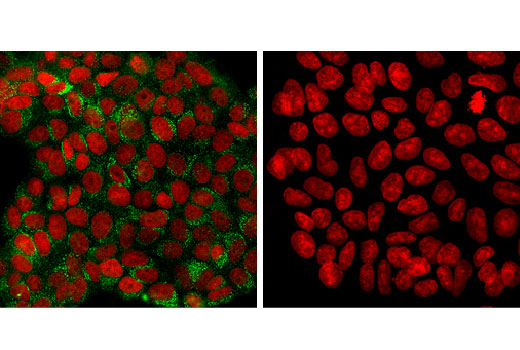 Confocal immunofluorescent analysis of MCF7 (left) and HCT-15 (right) cells using Sec31A (D1G7I) Rabbit mAb (green). Blue pseudocolor = DRAQ5® #4084 (fluorescent DNA dye).