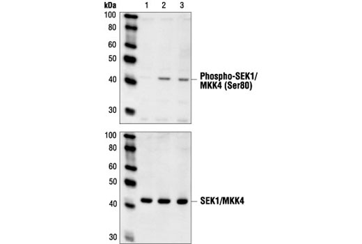 Western blot analysis of extracts from NIH/3T3 cells, untreated (lane 1), PDGF-treated (lane 2) or stably transfected with Src (lane 3), using Phospho-SEK1/MKK4 (Ser80) Antibody (upper) or SEK1/MKK4 Antibody #9152 (lower).