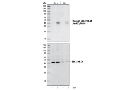 Western blot analysis of extracts from HeLa and C6 cells, untreated or UV-treated, using Phospho-SEK1/MKK4 (Ser257/Thr261) Antibody (upper) or SEK1/MKK4 Antibody #9152 (lower).