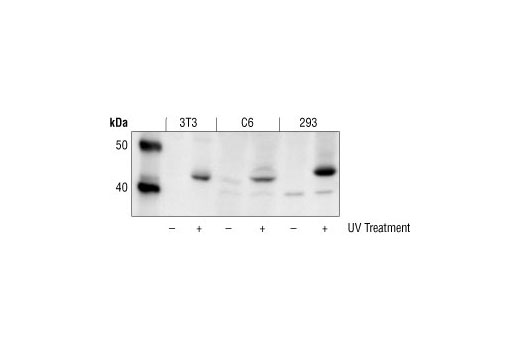 Western blot analysis of extracts from untreated and UV treated 3T3, C6 and 293 cells, using Phospho-SEK1/MKK4 (Thr261) Antibody.