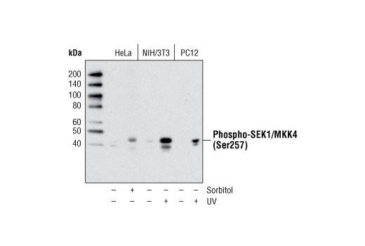 Western blot analysis of extracts from various cell lines, untreated or treated with sorbitol or UV, as indicated, using Phospho-SEK1/MKK4 (Ser257) (C36C11) Rabbit mAb.