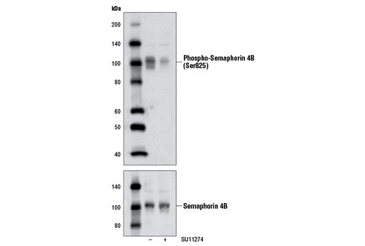 Western blot analysis of extracts from MKN-45 cells, untreated or SU11274-treated (1 μM for 2 hr), using Phospho-Semaphorin 4B (Ser825) Antibody (upper) and Semaphorin 4B Antibody #3355 (lower).