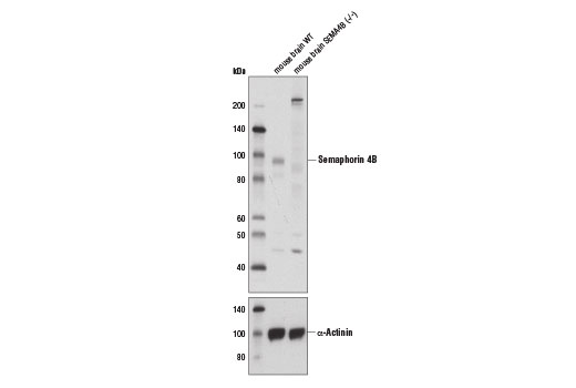 Western Blot analysis of cell extracts from either wild-type or SEMA4B (-/-) mouse brain using Semaphorin 4B Antibody (upper) or α-Actinin (D6F6) XP ® Rabbit mAb (lower). SEMA4B (-/-) mouse brain was provided by Dr. Oded Behar, Developmental Biology and Cancer Research, The Hebrew University of Jerusalem, Israel.