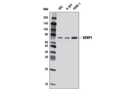 Western blot analysis of extracts from 293, A-204, and PANC-1 cells using SENP1 (D16D7) Rabbit mAb.