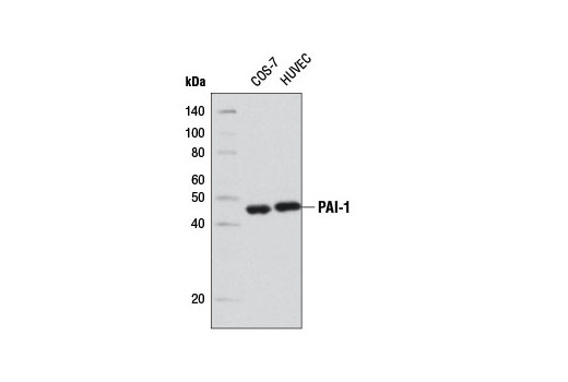 Western blot analysis of extracts from COS-7 and HUVEC cells using PAI-1 (D9C4) Rabbit mAb.