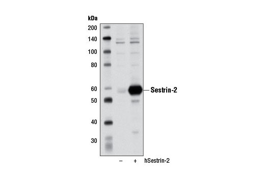 Western blot analysis of extracts from COS-7 cells, mock transfected (-) or transfected with a construct overexpressing full-length human sestrin-2 (hSestrin-2; +), using Sestrin-2 (D1B6) Rabbit mAb.
