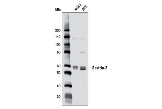 Western blot analysis of extracts from K-562 and 293T cells using Sestrin-2 (D1B6) Rabbit mAb.