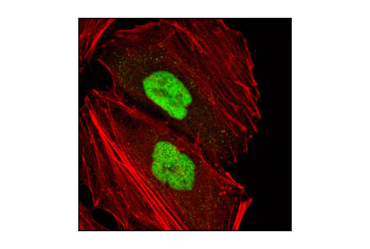 Confocal immunofluorescent analysis of HeLa cells using SET7/SET9 Antibody (green). Actin filaments have been labeled with Alexa Fluor® 555 phalloidin (red).
