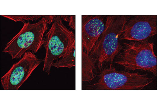 Confocal immunofluorescent analysis of HeLa cells, untreated (left) or treated with 0.5% Triton X-100 for 10 minutes prior to fixation according to Tardat et al. (2007) J. Cell Biol. 179, 1413-26 (right), using SET8 (C18B7) Rabbit mAb (green). Actin filaments have been labeled with DY-554 phalloidin (red). Blue pseudocolor = DRAQ5™ (fluorescent DNA dye).