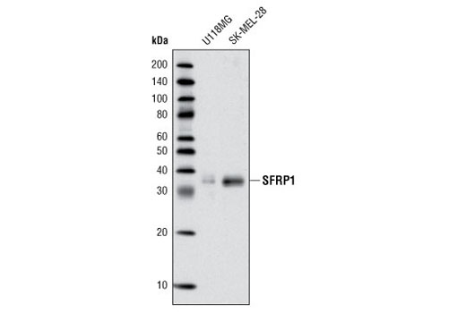Western blot analysis of extracts from U118MG and SK-MEL-28 cells using SFRP1 Antibody.