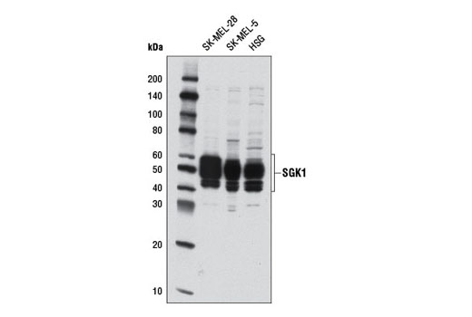 Western blot analysis of extracts from SK-MEL-28, SK-MEL-5, and HSG cells using SGK1 (D27C11) Rabbit mAb.
