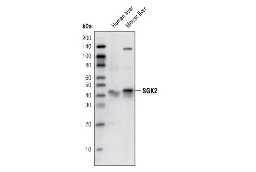 Western blot analysis of extracts from human and mouse liver tissues using SGK2 Antibody.