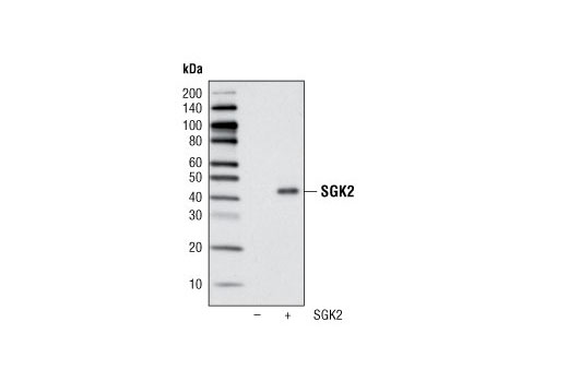 Western blot analysis of extracts from COS-7 cells, untransfected (-) or transfected with human SGK2 (+), using SGK2 Antibody.