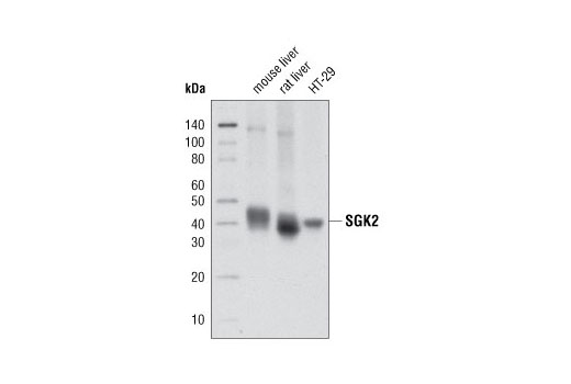 Western blot analysis of extracts from HT-29 cells, mouse liver, and rat liver using SGK2 (D7G1) Rabbit mAb.