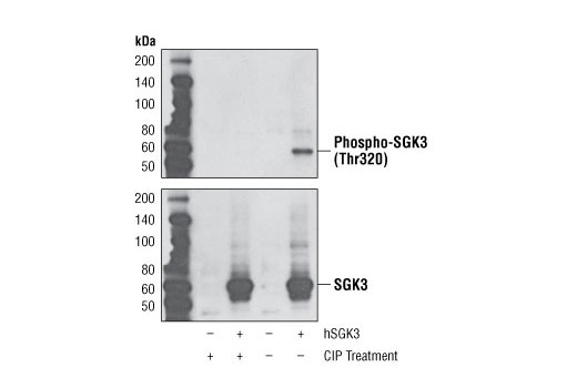 Western blot analysis of extracts from COS-7 cells, untransfected or transfected with human SGK3, and untreated or treated with calf intestinal phosphatase (CIP), using Phospho-SGK3 (Thr320) (D30E6) Rabbit mAb (upper) or SGK3 Antibody #4227 (lower).