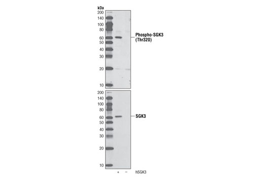 Western blot analysis of extracts from COS-7 cells, untransfected (-) or transfected with human SGK3 (+), using Phospho-SGK3 (Thr320) (D30E6) Rabbit mAb (upper) or SGK3 Antibody #4227 (lower).