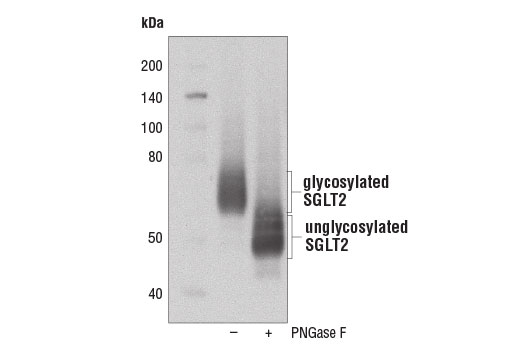 Western blot analysis of extacts from human kidney membrane fraction lysates, untreated (-) or treated with PNGase F (+), using SGLT2 Antibody.