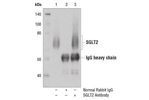 Immunoprecipitation of SGLT2 from human kidney membrane extracts using Normal Rabbit IgG #2729 (lane 2) or SGLT2 Antibody (lane 3). Lane 1 is 10% input. Western blot analysis was performed using SGLT2 Antibody.
