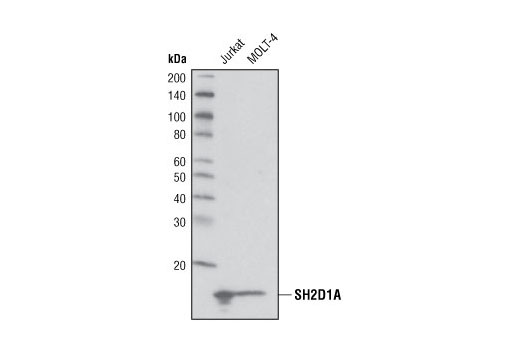 Western blot analysis of extracts from Jurkat and MOLT-4 cells using SH2D1A (D10G8) Rabbit mAb.