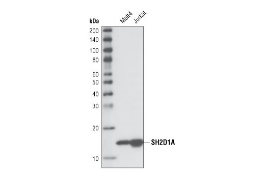 Western blot analysis of total cell lysates from Molt4 and Jurkat cells using SH2D1A (XLP 1D12) Rat mAb.