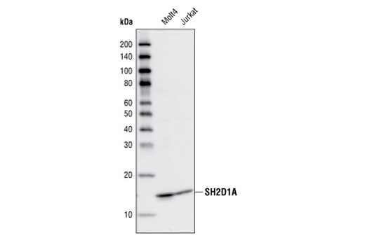 Western blot analysis of total cell lysates from Molt4 and Jurkat cells using SH2D1A Antibody.