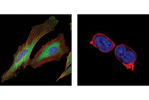 Confocal immunofluorescent analysis of HeLa (left) and Jurkat cells (right) using SHIP2 (C76A7) Rabbit mAb (green). Actin filaments have been labeled with DY-554 phalloidin (red). Blue pseudocolor = DRAQ5 ® #4084 (fluorescent DNA dye).