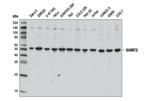 Western blot analysis of extracts from various cell lines using SHMT2 Antibody.