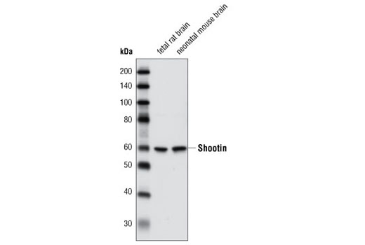 Western blot analysis of extracts from neonatal mouse and fetal rat brain using Shootin1 Antibody.