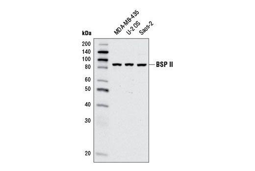 Western blot analysis of extracts from MDA-MB-435, U-2 OS, and Saos-2 cells using BSP II Antibody.
