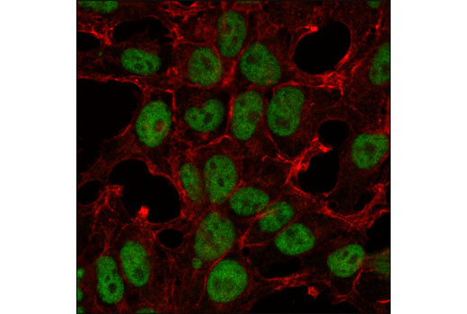 Confocal immunofluorescent analysis of 293 cells using SIN3A (D9D6) Rabbit mAb (green). Actin filaments were labeled with DY-554 phalloidin (red).