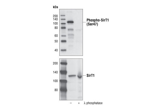 Western blot analysis of 293 cell lysates treated or untreated with λ phosphatase, using Phospho-SirT1 (Ser47) Antibody #2314 (upper) or SirT1 Antibody #2310 (lower).