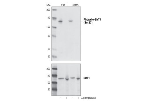 Western blot analysis of 293 and HCT15 cell lysates treated or untreated with lambda phosphatase using Phospho-SirT1 (Ser27) Antibody #2327 (upper) or SirT1 Antibody #2310 (lower).