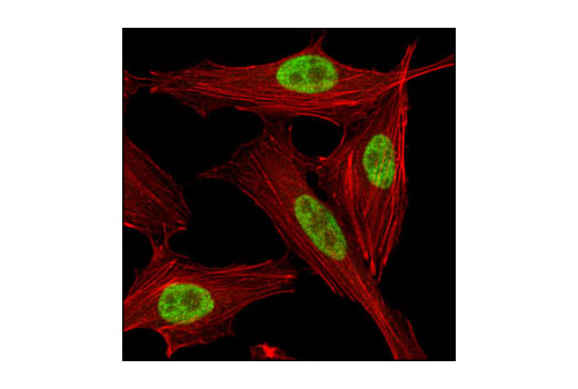 Confocal immunofluorescent analysis of HeLa cells using SirT1 (D739) Antibody (green). Actin filaments have been labeled with Alexa Fluor® 555 phalloidin (red).