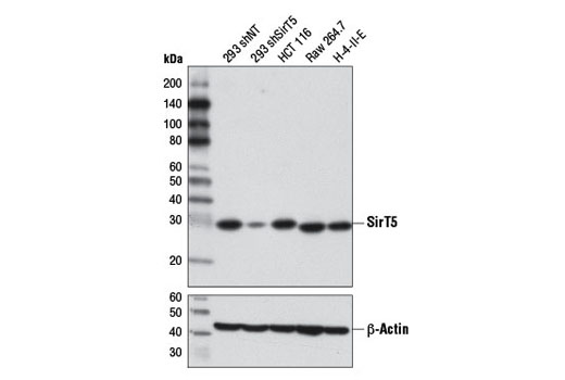 Western blot analysis of extracts from 293 cells, expressing either nontargeting shRNA (293 shNT) or shRNA targeting SirT5 (293 shSirT5), and HCT 116, Raw 264.7, and H-4-II-E cells using SirT5 (D8C3) Rabbit mAb (upper) or β-Actin (D6A8) Rabbit mAb #8457 (lower). 293 shNT and 293 shSirT5 cells were kindly provided by David Lombard, University of Michigan.